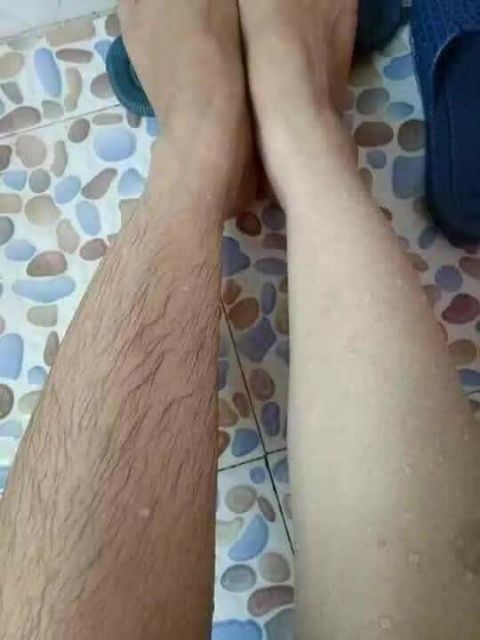 (MUA 1 tặng 1 serum)Kem Triệt Râu Lông BiKiNi Vĩnh Viễn Dưỡng Da Không Mọc Lại Tặng kèm serum ức chế mọc lại | BigBuy360 - bigbuy360.vn