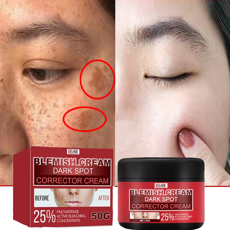 Kem dưỡng trắng da mặt làm trắng da và xóa mờ vết thâm