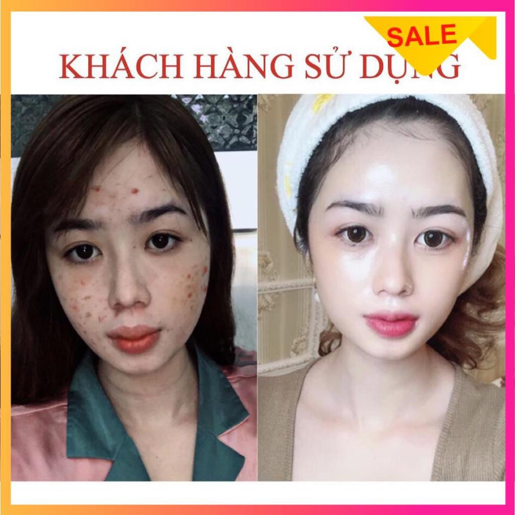 [SIÊU KHUYẾN MÃI] Serum giảm mụn thâm rỗ Seimy - Skin 7 Days | BigBuy360 - bigbuy360.vn