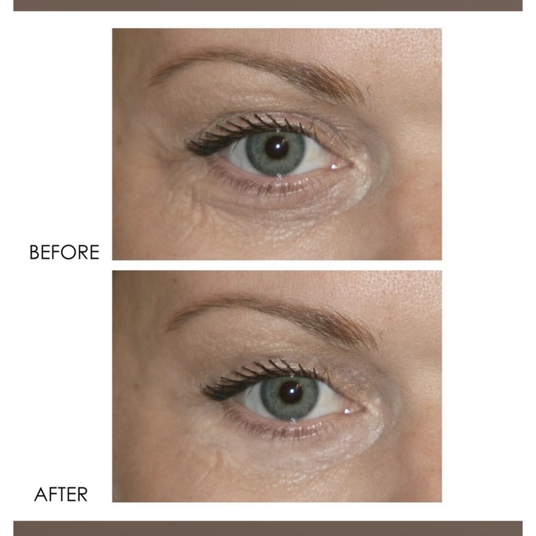 (Boxy Charm) Kem mắt cao cấp Dermelect giảm nhăn, giảm thâm quầng REVITALITE PROFESSIONAL Eyelid Dark Circle Corrector
