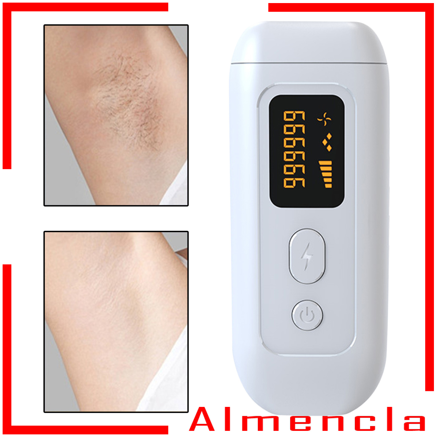 (Hàng Mới Về) Máy Tẩy Lông Bằng Laser Vĩnh Viễn Phích Cắm Eu 990000