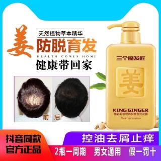 Dầu Gội Gừng Chống Gàu Kiềm Dầu hỗ trợ giảm Gàu Tóc Hiệu Quả