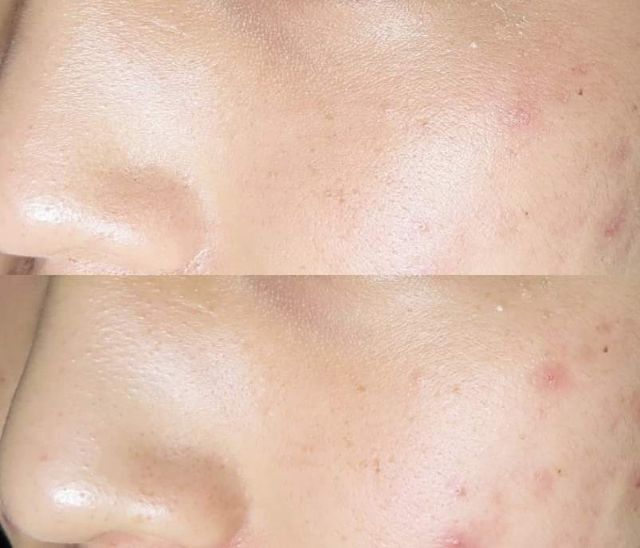 TẨY DA CHẾT THE FACE SHOP NGỌC TRAI ĐƯỜNG ĐEN | BigBuy360 - bigbuy360.vn