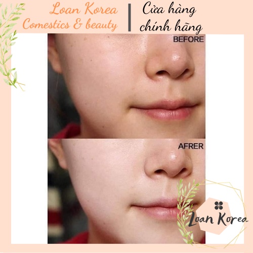 SERUM DƯỠNG TRẮNG NIACINAMIDE B3 20% LUMIDERM