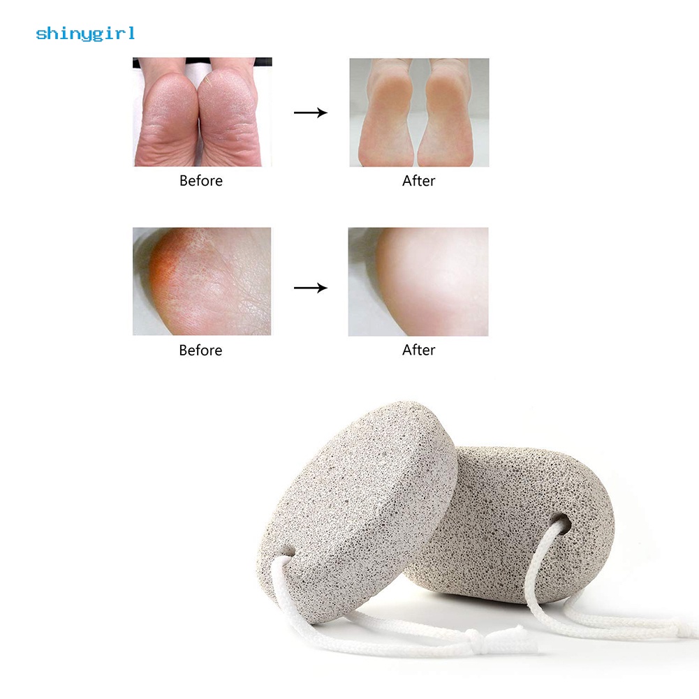 Đá bọt chà gót chân hình loại bỏ tế bào da chết tiện lợi