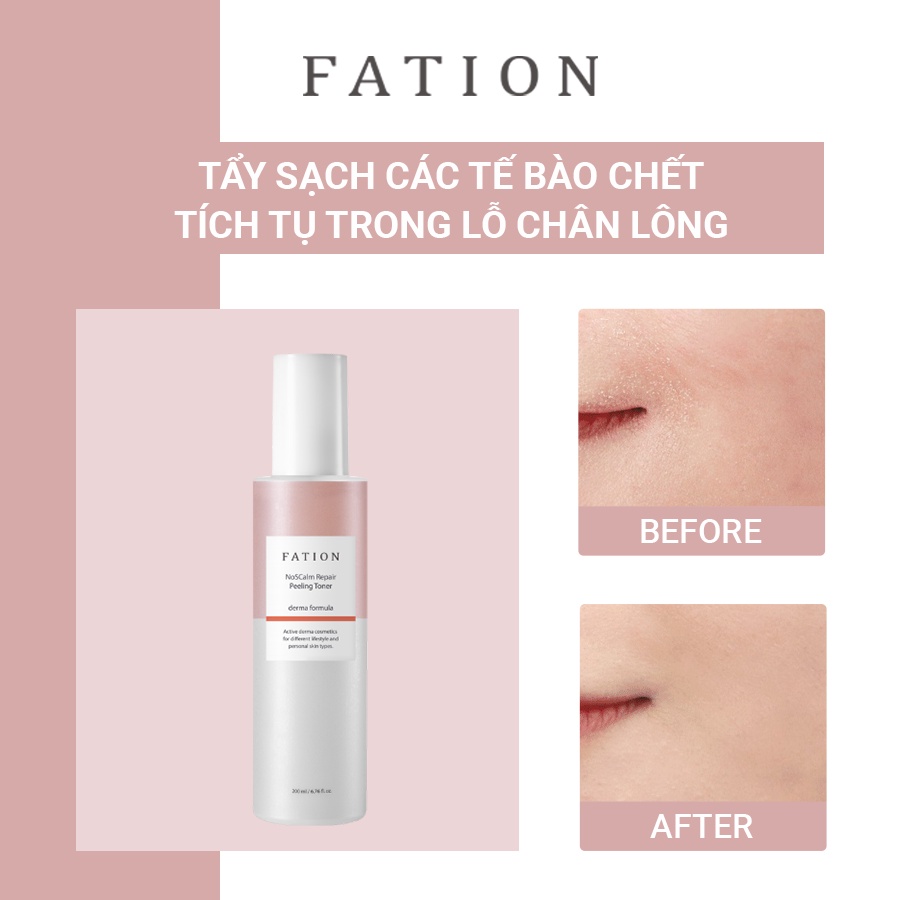 Nước Hoa Hồng Tẩy Tế Bào Chết FATION NoSCalm Repair Peeling Toner 200ml