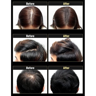 Phấn Dashu chống rụng tóc, hair cushion 26g [sunflower1968]