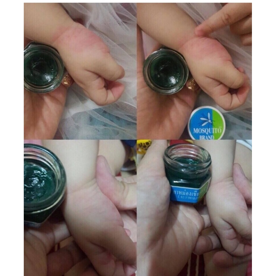 Sáp muỗi đốt an toàn cho bé Green Balm Mosquito Brand