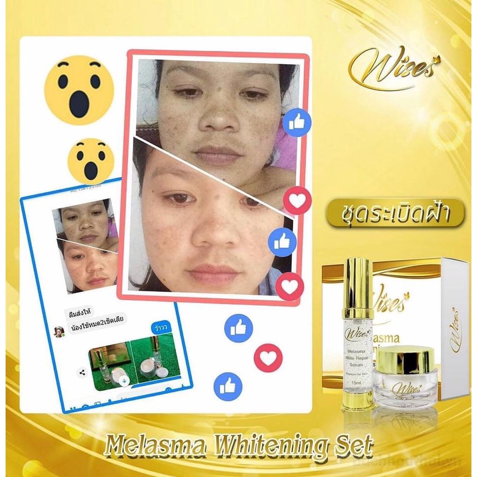 Bộ dưỡng mờ ṫhâm ņám tàn nhanǥ Wises Whitening Set Thailand