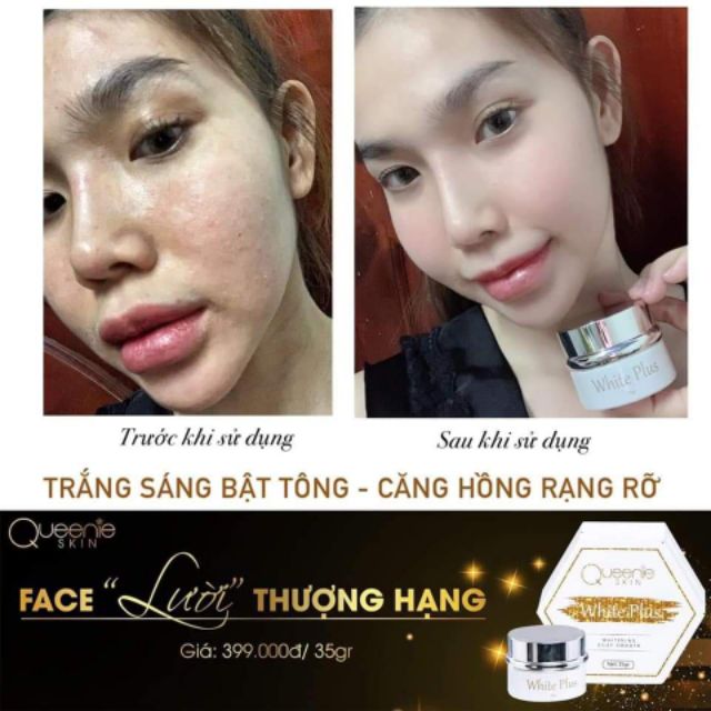 FACE LƯỜI THƯỢNG HẠNG QUEENIE SKIN[tặng son cao cấp]