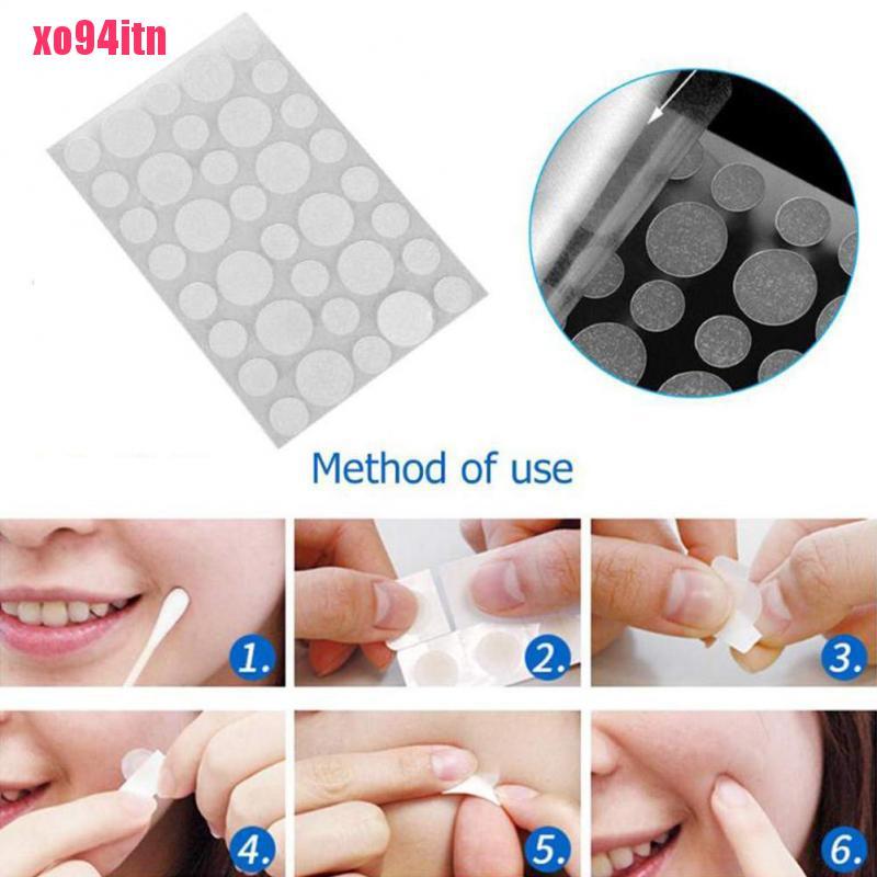[Hàng mới về] Set 36 miếng dán hỗ trợ giảm mụn hydrocolloid hiệu quả