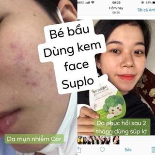 Combo 2 Kem Face Súp Lơ từ Hàn Quốc