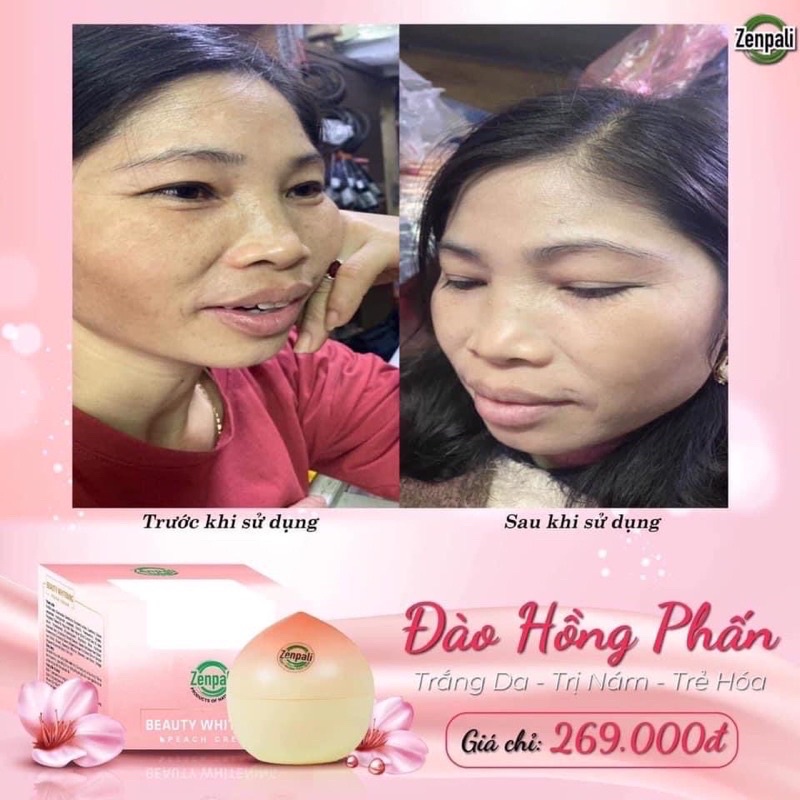 Đào Hồng Phấn [chính hãng]