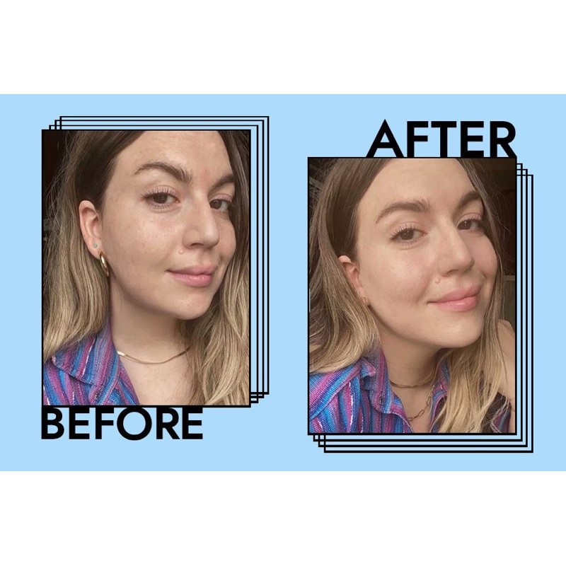 [TOP 1 UY TÍN] Kem Che Khuyết Điểm The Ordinary Concealer High Coverage Formula | BigBuy360 - bigbuy360.vn