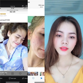 Kem mụn dưỡng da hoa đào