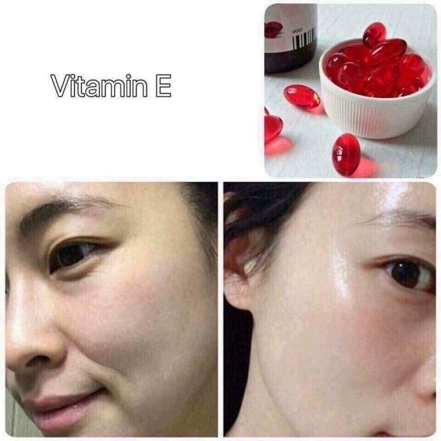 Lọ 30 viên viên uống Vitamin E Zentiva 400mg Nga | BigBuy360 - bigbuy360.vn