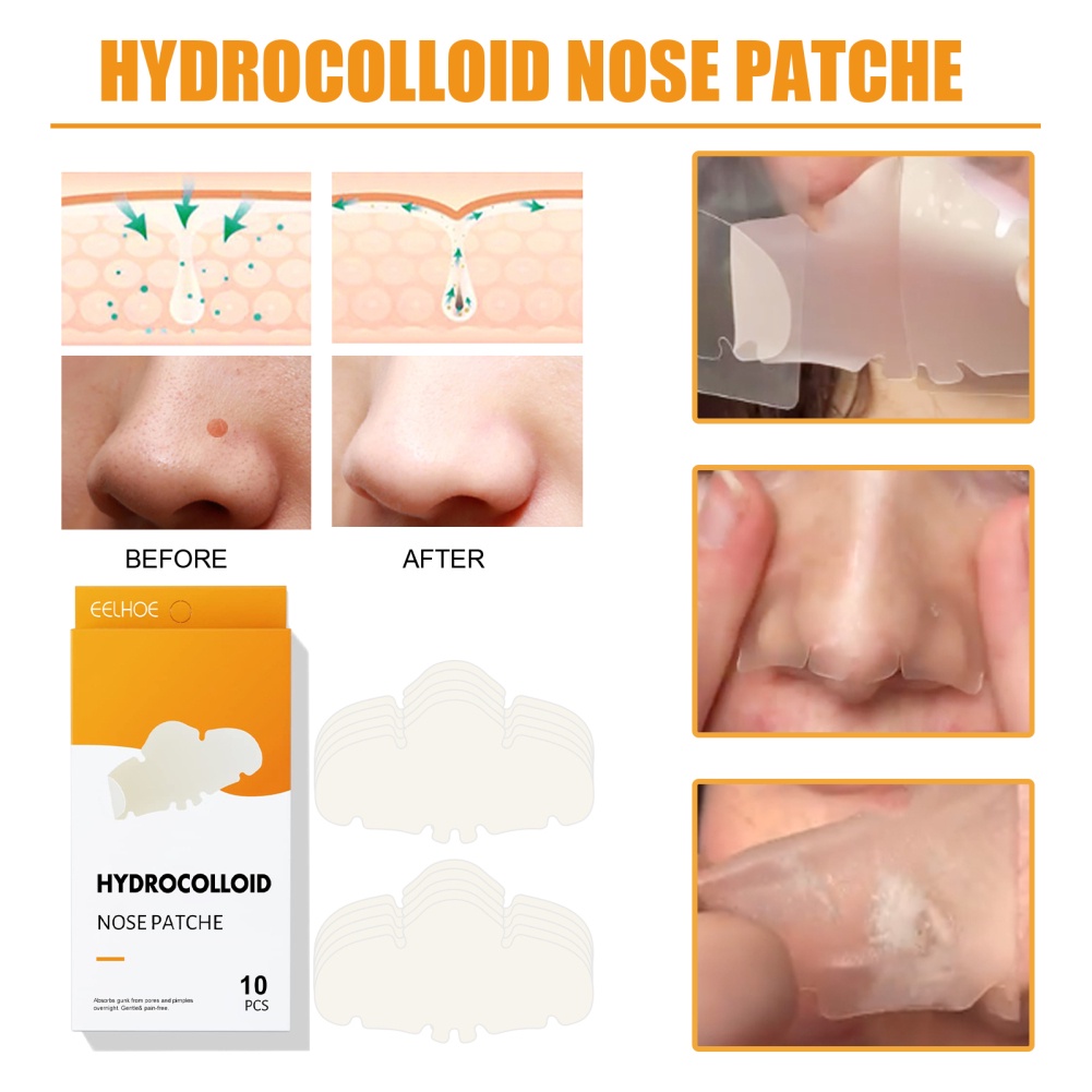 Miếng Dán EELHOE Miếng Dán Hydrocolloid Mũi Cho Lỗ Chân Lông Mũi Mụn Nhọt Và Miếng Dán Lỗ Chân Lông Dầu Qua Đêm Để Hấp Thụ Mụn Mũi Gunk Mặt Nạ Mũi (10 Số)-Ampere