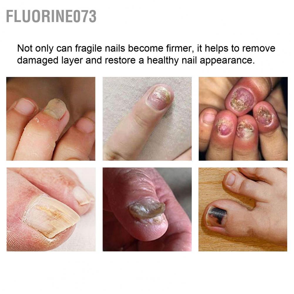Fluorine073 3ml Pocket Cuticle Pen Nail Revitalizer Oil Manicure Tool để sửa chữa