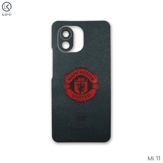 Dán da Xiaomi Mi 11 theo yêu cầu