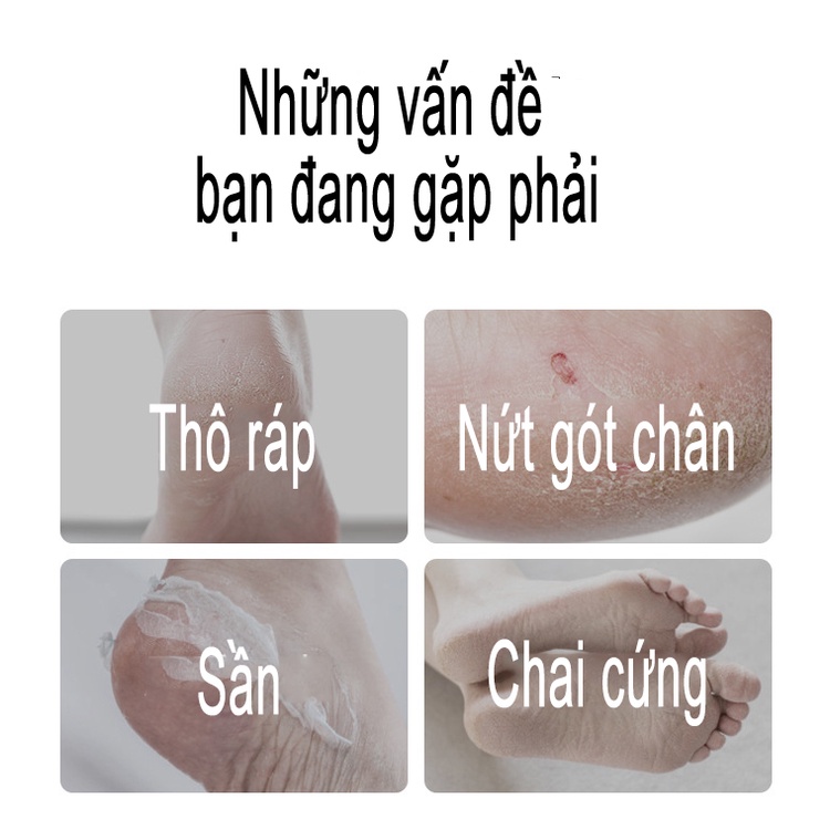 Mặt nạ ủ dưỡng da chân, mềm mại, giải quyết các vấn đề thô ráp, chai sần ở gót chân, bàn chân MOCCO Nội địa trung