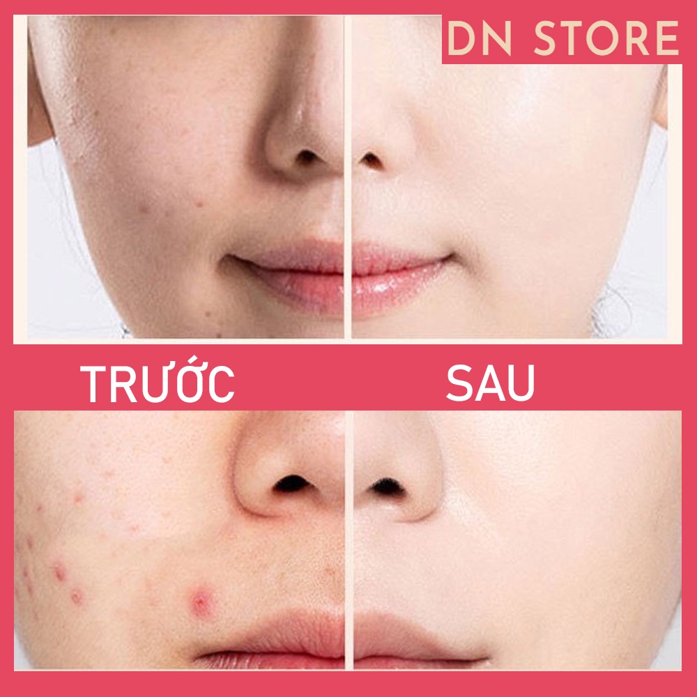 Kem Che Trang Điểm, Makeup Khuyết Điểm LAMEILA, Chống Nước Lì Mịn Dành Cho Mọi Tông Da - Mỹ Phẩm Nội Địa Trung | BigBuy360 - bigbuy360.vn