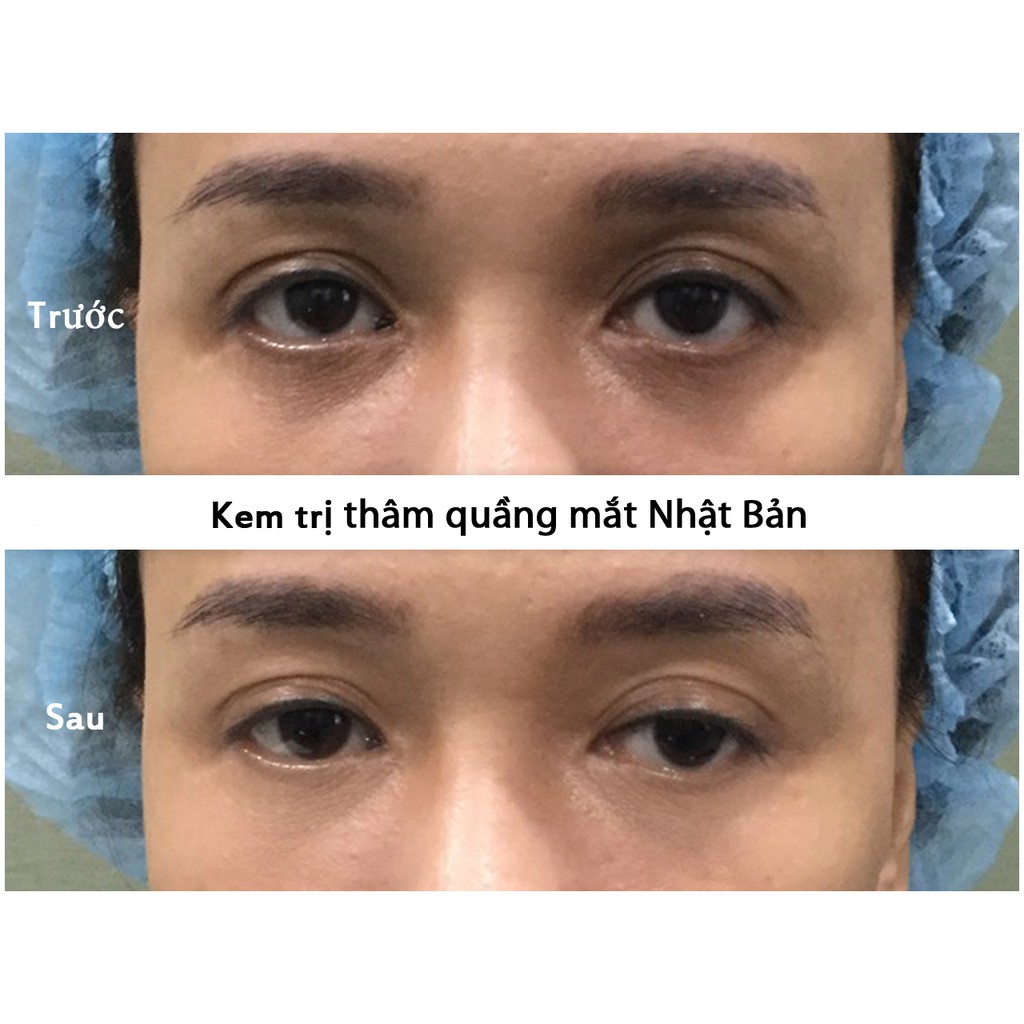 Kem Dưỡng Mắt Giảm Thâm Quầng Mắt Kumargic Eye Nhật Bản Chính Hãng - Thẩm Mỹ Huyền Trang