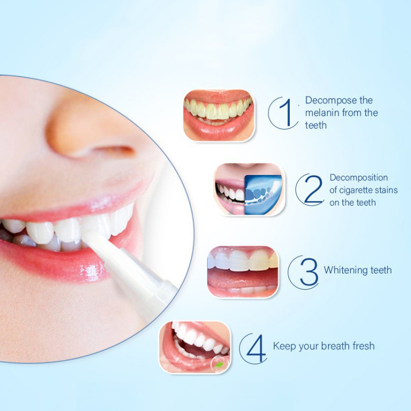 Bút Gel Làm Trắng Răng Loại Bỏ Vết Bẩn Chất Lượng Cao