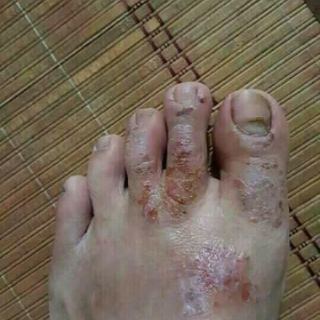 Kem đa năng Mul Rose