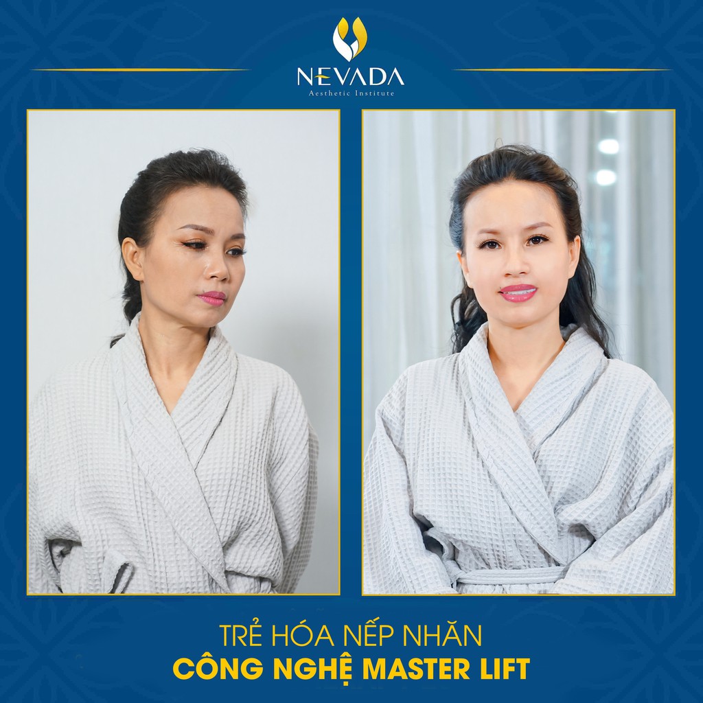 Hà Nội - Hồ Chí Minh [E-Voucher] Nâng Cơ Trẻ Hóa Da Xóa Nhăn Công Nghệ Master Lift Tại TMV Nevada