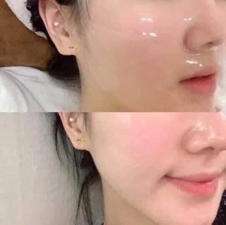 [ AUTH HÀNG SẴN] Mặt nạ thạch sinh học Celderma