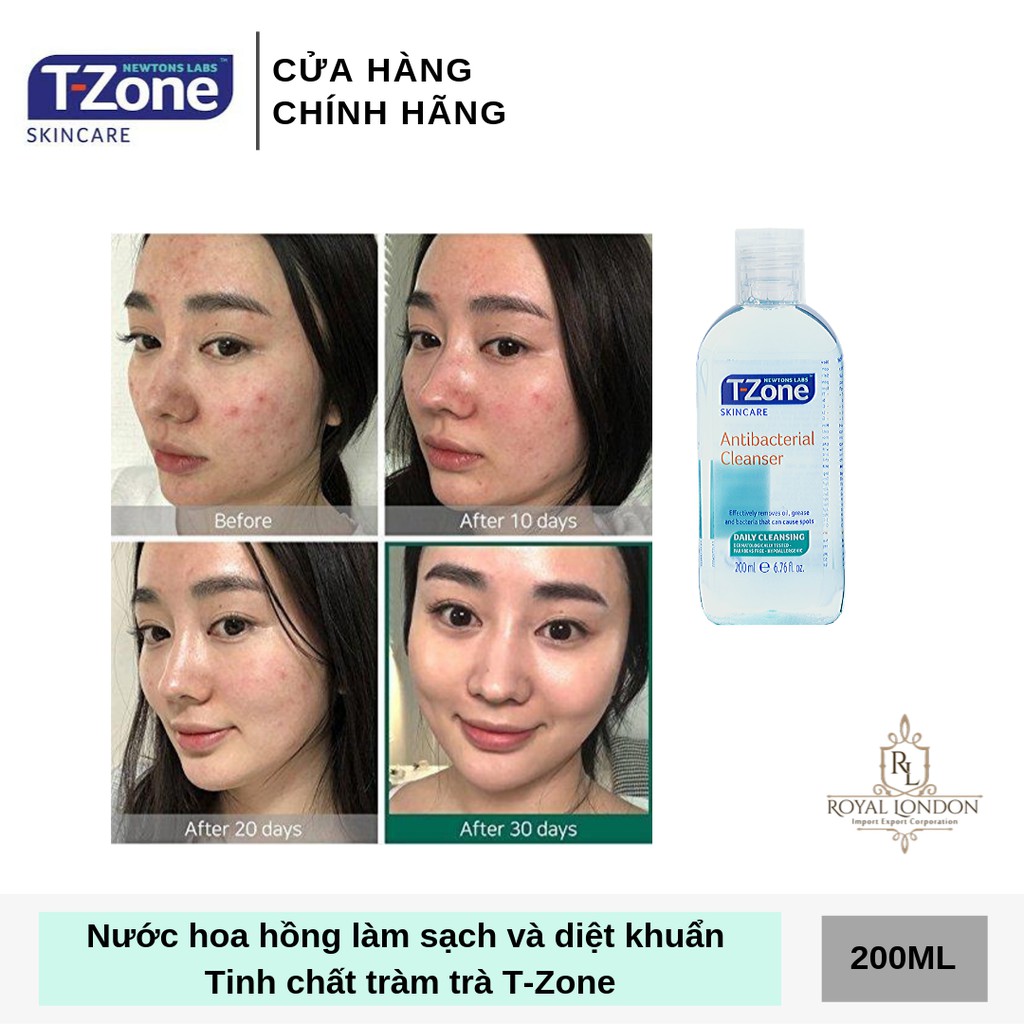 Toner Làm Sạch, Diệt Khuẩn Tinh Chất Tràm Trà T-Zone 200ml