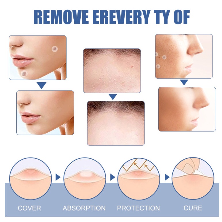 Miếng dán mụn SKIN TAG PATCH,  giảm sưng mụn đầu đen, mụn ruồi, mụn cơm  tái tạo da tự nhiên 144 miếng dán - soleil shop