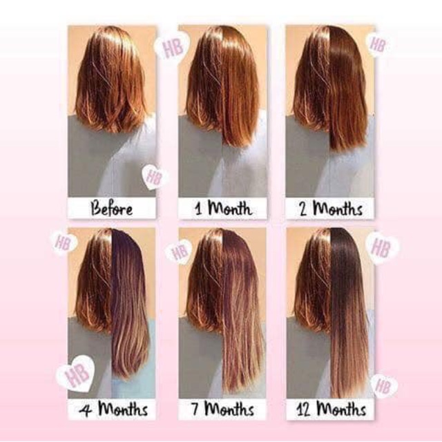 Dầu gội biotinnnnn