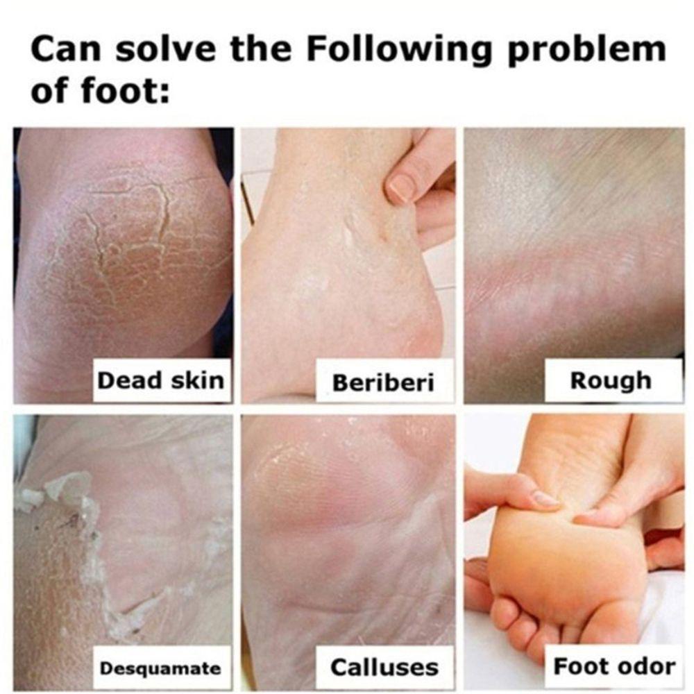 Vớ Gel Chăm Sóc Da Gót Chân Dưỡng Ẩm Mịn Màng Có Thể Tái Sử