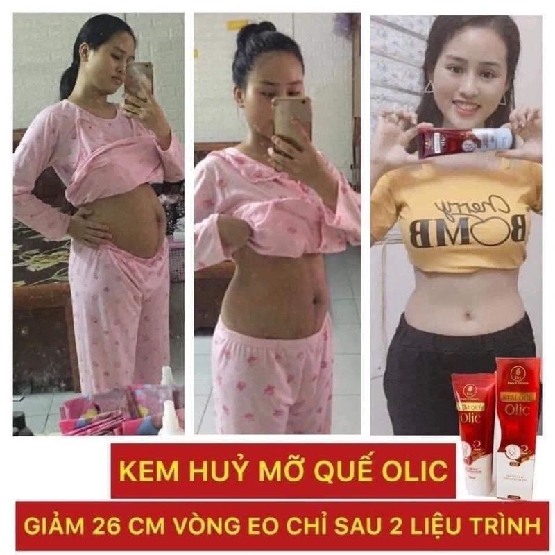 KEM TAN MỠ OLIC HÀNG CHÍNH HÃNG 100%( tặng kèm đai định hình cao cấp)