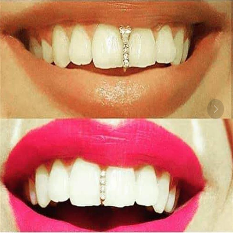 Trang sức răng trên đính đá pha lê nhân tạo phong cách hip hop hóa trang