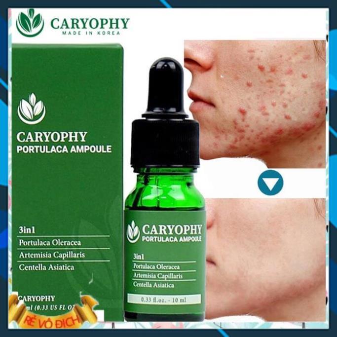 ⭐ Serum làm lành mụn và thâm Caryophy Mụn Ẩn,Mụn Đầu Đen -Sachi