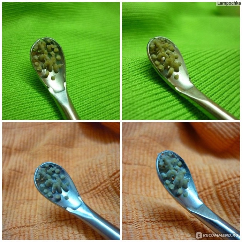 Thìa lấy mụn, nặn mụn trong spa