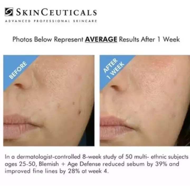 SKINCEUTICALS Tinh Chất Chống Lão Hóa Blemish+ Age Defense (Minisize 4ml)