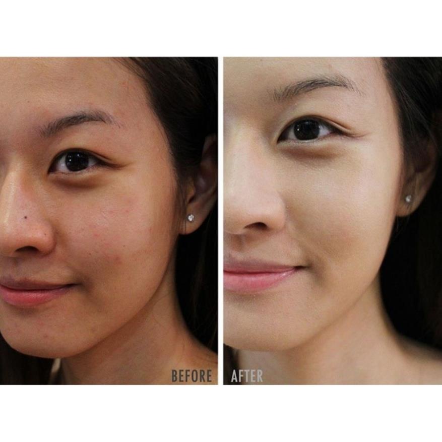 [Hỏa tốc] Kem chống lão hóa RETINOL 0.5% Nanogize Retinol Nano 20ml