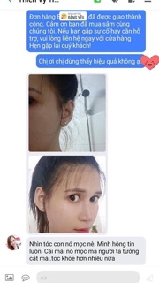 Bộ sản phẩm chăm sóc tóc NARE