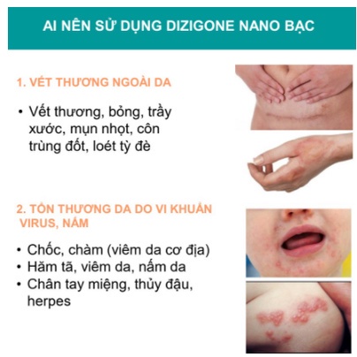 Kem Dizigone nano bạc - Kháng khuẩn, lành vết thương, tái tạo da, ngăn ngừa sẹo