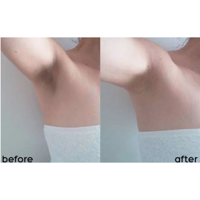 [Phiên Bản Nâng Cấp] Lăn Khử Mùi  Dưỡng Trắng Da Angel's Liquid Glutathione+ Niacinamide Fresh Deodorant 60ml | BigBuy360 - bigbuy360.vn