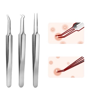 Bộ nặn mụn 6 món kim loại không gỉ cao cấp