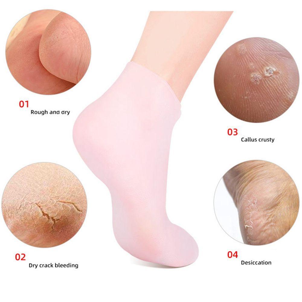 FORBETTER Đệm Silicone Lót Giày Bảo Vệ Chân Chống Nứt Nẻ Co Giãn