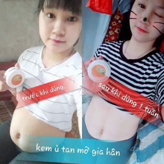 Link sỉ đai gen bụng