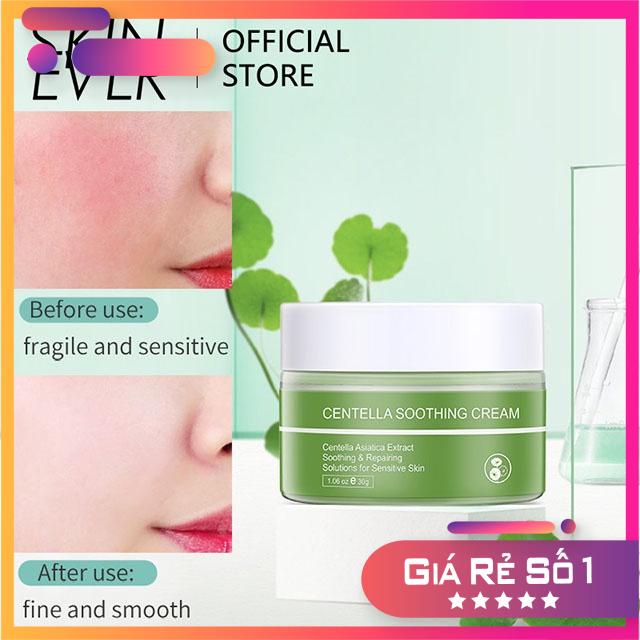 Kem Dưỡng Da Chiết Xuất Rau Má Dưỡng Ẩm Không Gây Dị Ứng Skin Ever - 30g