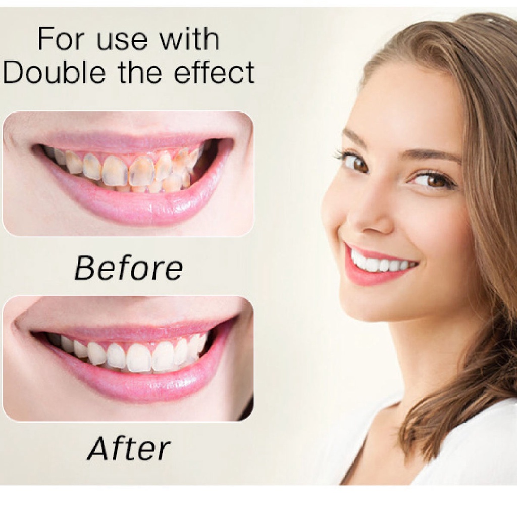 Máy làm trắng răng tại nhà Smile Kit, Máy tẩy trắng răng bằng kem cực đơn giản, nguyên liệu thiên nhiên tốt cho sức khỏe