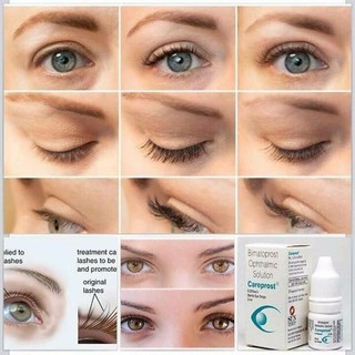 Serum Dưỡng Dài Mi Ấn Độ Careprost (CHÍNH HÃNG)