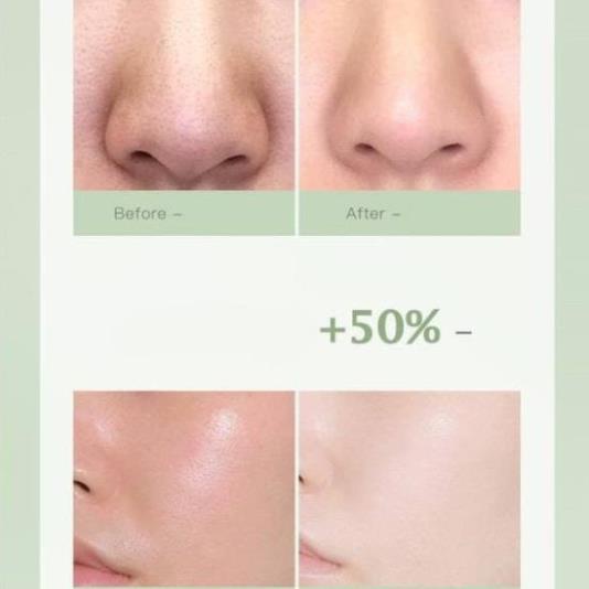 Mặt Nạ Đất Sét, Mặt Nạ Bùn Trà Xanh Làm Sạch Mụn Đầu Đen Kiềm Dầu Làm Sáng Da LALA